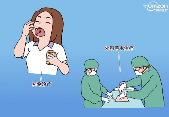 用盆底康復(fù)治療儀輕松解決尿急、尿頻、夜尿問題