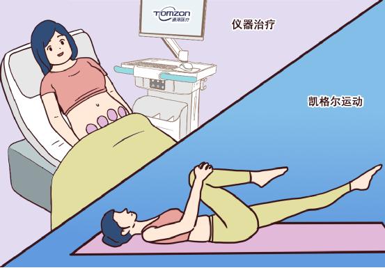 盆底肌恢復(fù)儀是一種什么樣的儀器？