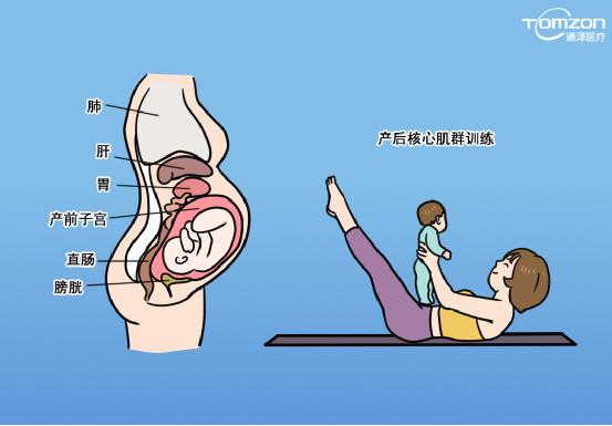 盆底肌修復儀器 盆底肌修復儀器