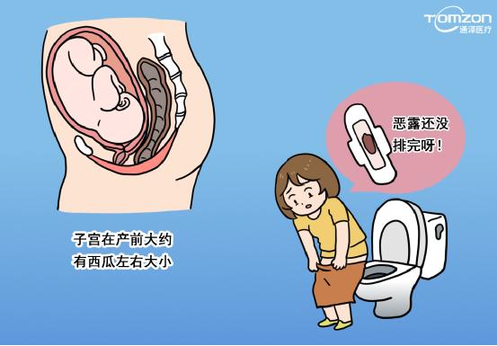 盆底肌修復儀器 盆底肌修復儀器